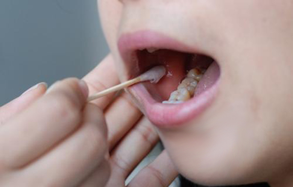 福州医院办理血缘检测生物检材有什么,福州医院办理DNA亲子鉴定准不准确 福州医院办理血缘检测生物检材有什么,福州医院办理DNA亲子鉴定准不准确